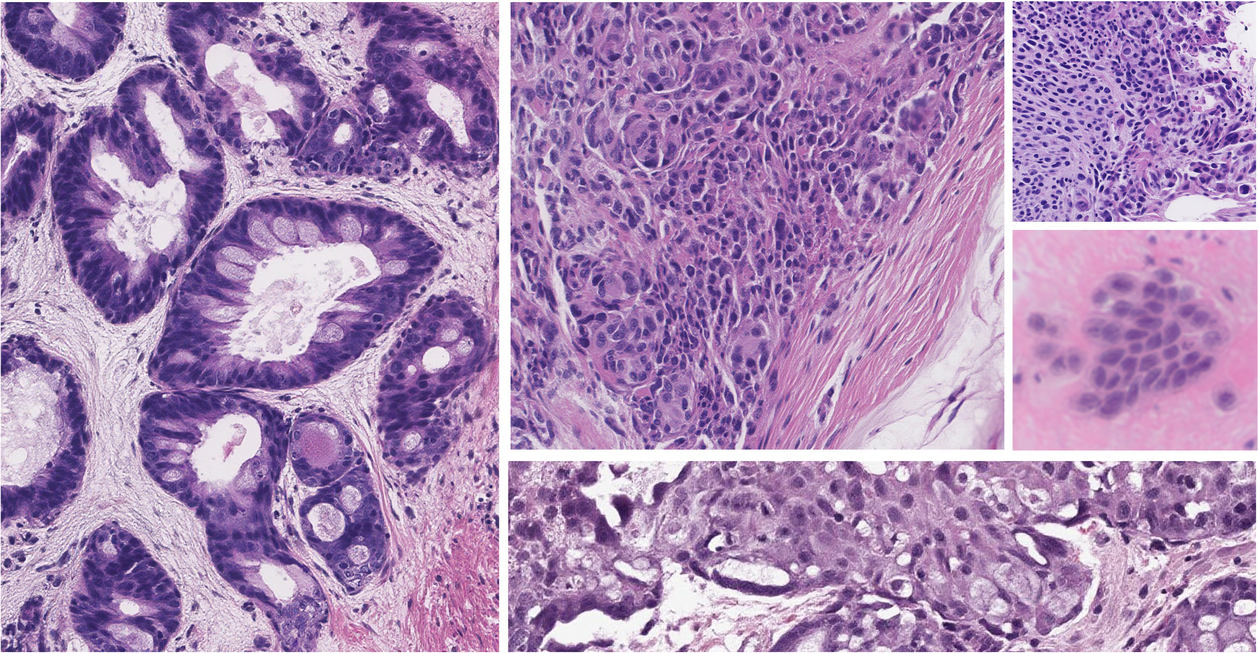 Histopathology